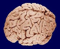 The human brain