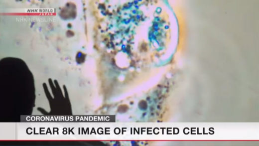 A doctor watching 8K footage of infected cells