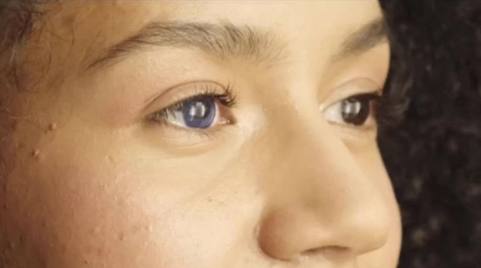 Eye effects: the subtle art of digital eye surgery 1
