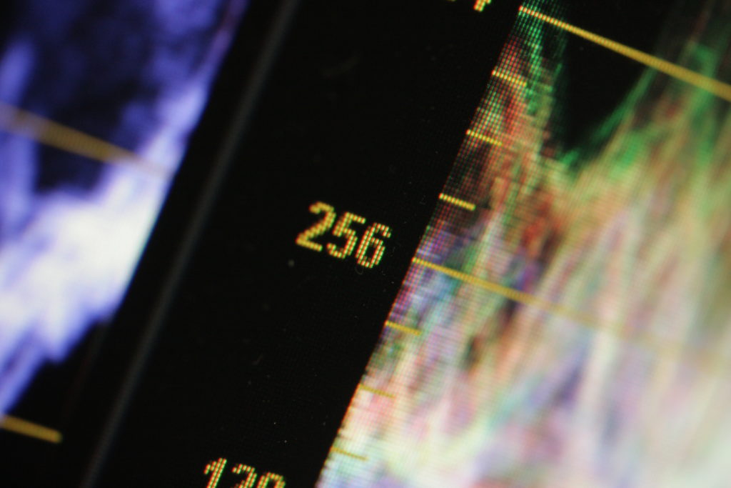 Closeup of an RGB waveform display in the Resolve grading software