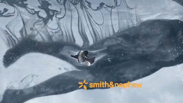 Smith & Nephew VERILAST Commercial 7 Smith & Nephew VERILAST Commercial 6